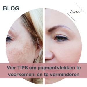 blog pigmentvlekken huid